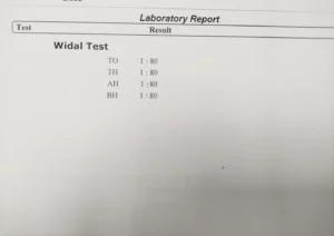 widal test report