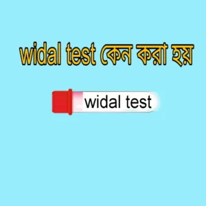 widal test 