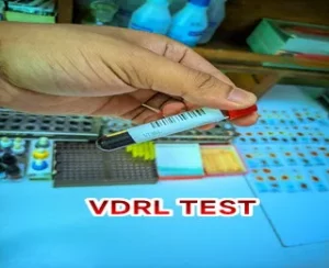 aRaFaTh94 20230522 140214 thambnail vdrl test কি?vdrl test কেন করা হয়? vdrl test পজিটিভ মানে কি?vdrl test price in bangladesh?