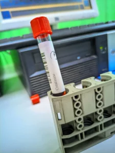 creatinine test tube