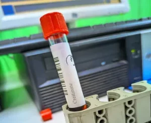 creatinine test tube