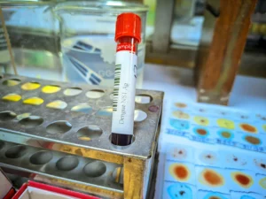 ns1 dengue test tube