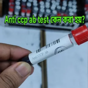 anti ccp test কেন করা হয়