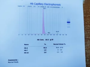 hb electrophoresis test normal report