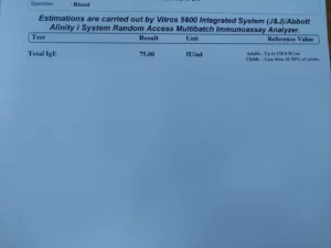 serum ige test report