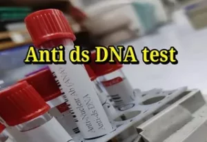 anti ds dna test কেন করা হয়