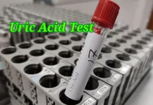 IMG 20230609 074303thambnail 1 uric acid test কেন করা হয় ? ইউরিক এসিড বেশি বা কম হলে কি হয়? নরমাল কত, খরচ কত? || uric acid test details.