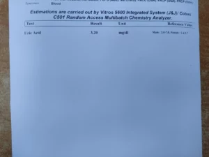 uric acid test report