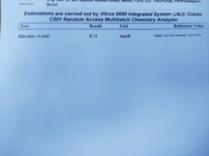 bilirubin test report