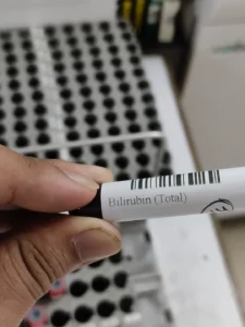 bilirubin test sample tube 