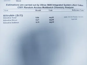 bilirubin D/I test report