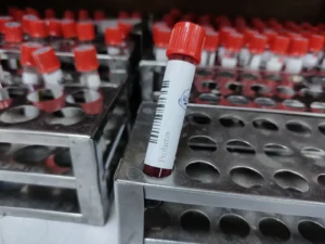 prolactin test sample tube