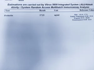 prolactin test report