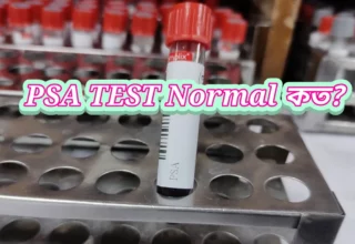 psa test normal