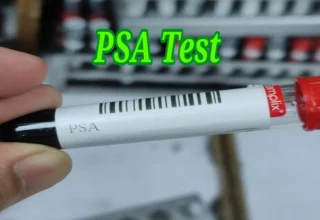 psa test কেন করা হয়