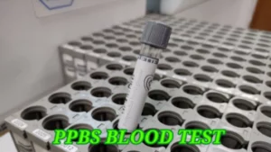 ppbs blood test