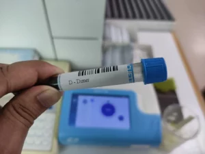 d-dimer test sample tube