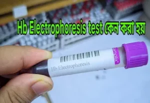 hb electrophoresis test কেন করা হয়