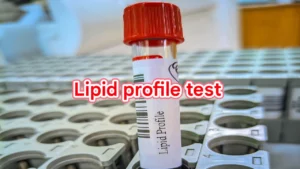 lipid profile test details in bangla.