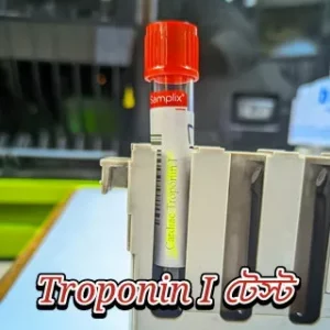 aRaFaTh94 20230531 185200 thambnail troponin i test কেন করা হয়? স্বাভাবিক মাত্রা কত , খরচ কত ? ট্রোপোনিন উচ্চ মাত্রার কারণ কি?