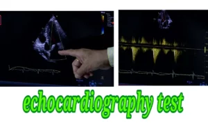 echocardiography