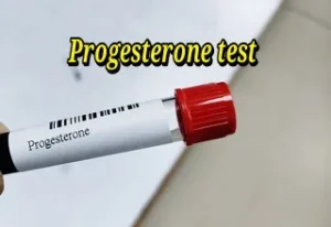 Progesterone test