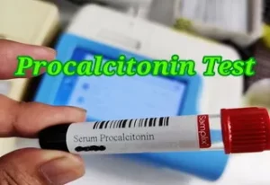 Procalcitonin Test