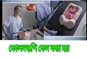 কোলনস্কপি কেন করা হয়