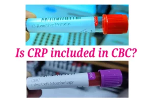 Is CRP included in CBC