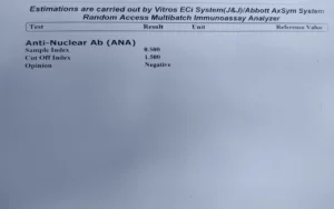 ANA negative results report