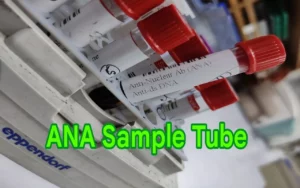 ana sample tube