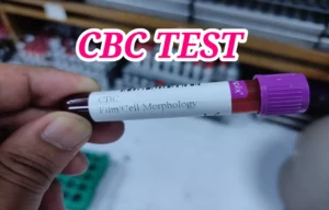 cbc test