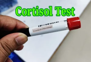 cortisol test sample tube