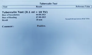 tb test report