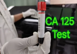 CA125 test sample tube