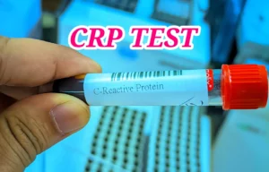 crp test