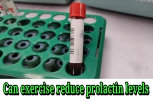 Can exercise decrease prolactin levels