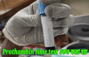 Prothombin time test কেন করা হয়