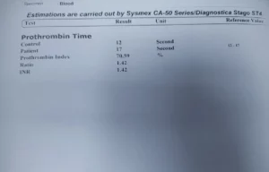 Prothombin time test normal range