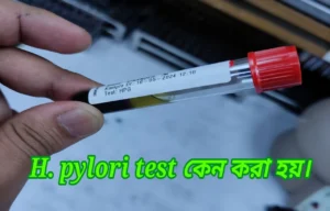 h pylori test কেন করা হয়