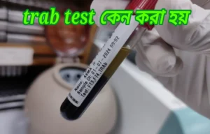 TRAB test কেন করা হয়