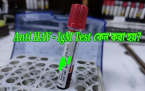 Anti HAV IgM test কেন করা হয়