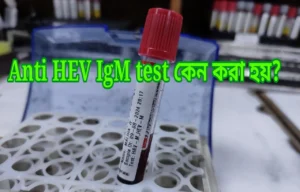 anti HEV IgM test কেন করা হয় ?