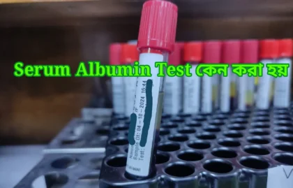 serum albumin কি এবং কেন করা হয়?