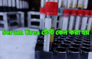 Serum Urea টেস্ট কেন করা হয় ?